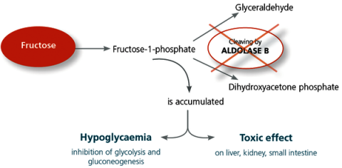 Fructose malabsorption causes, diagnosis, symptoms & management